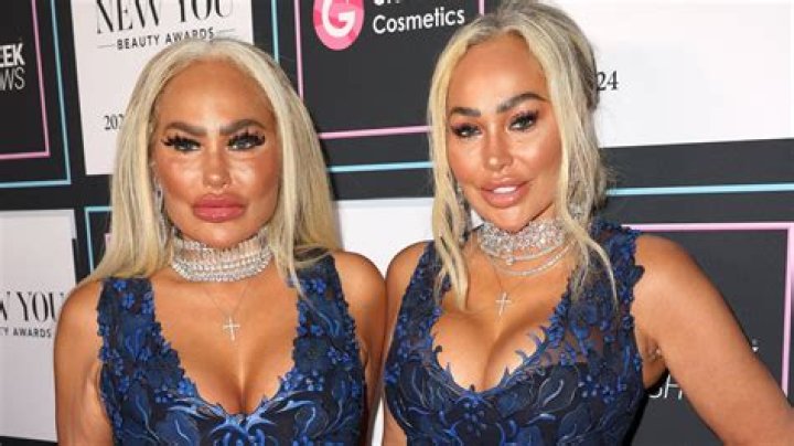 Pictures: Darcey And Stacey Before And After Plastic Surgery? Parents Nationality & Ethnicity