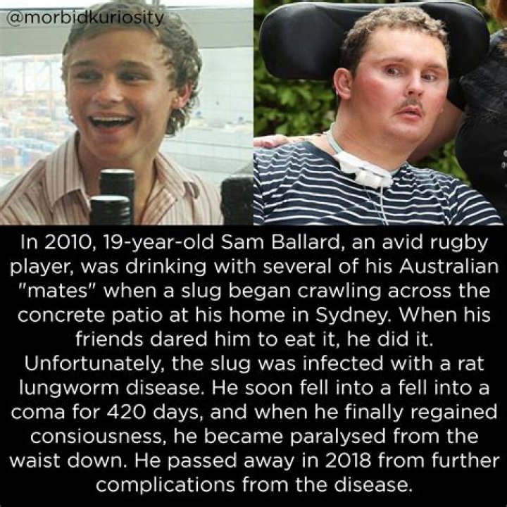 Reddit Discusses The Case Of Rugby Player Sam Ballard Who Died Of A Slug