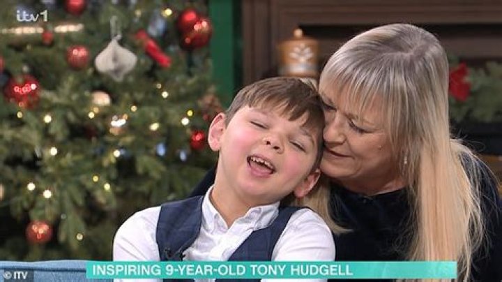 Tony Hudgell Story Makes Everyone Emotional- What Exactly Happened To The Evil Parents After Getting Caught?