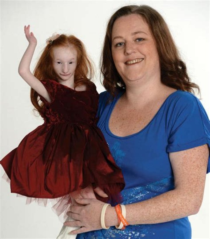 Who Is Charlotte Garside? Is Worlds Smallest Girl Dead or Alive? Wikipedia Update